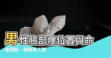 癦位置